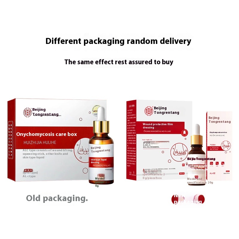Beijing Tongrentang Yimeitang Onychomycosis Care Box Set Onychomycosis Care Solution Dropshipping